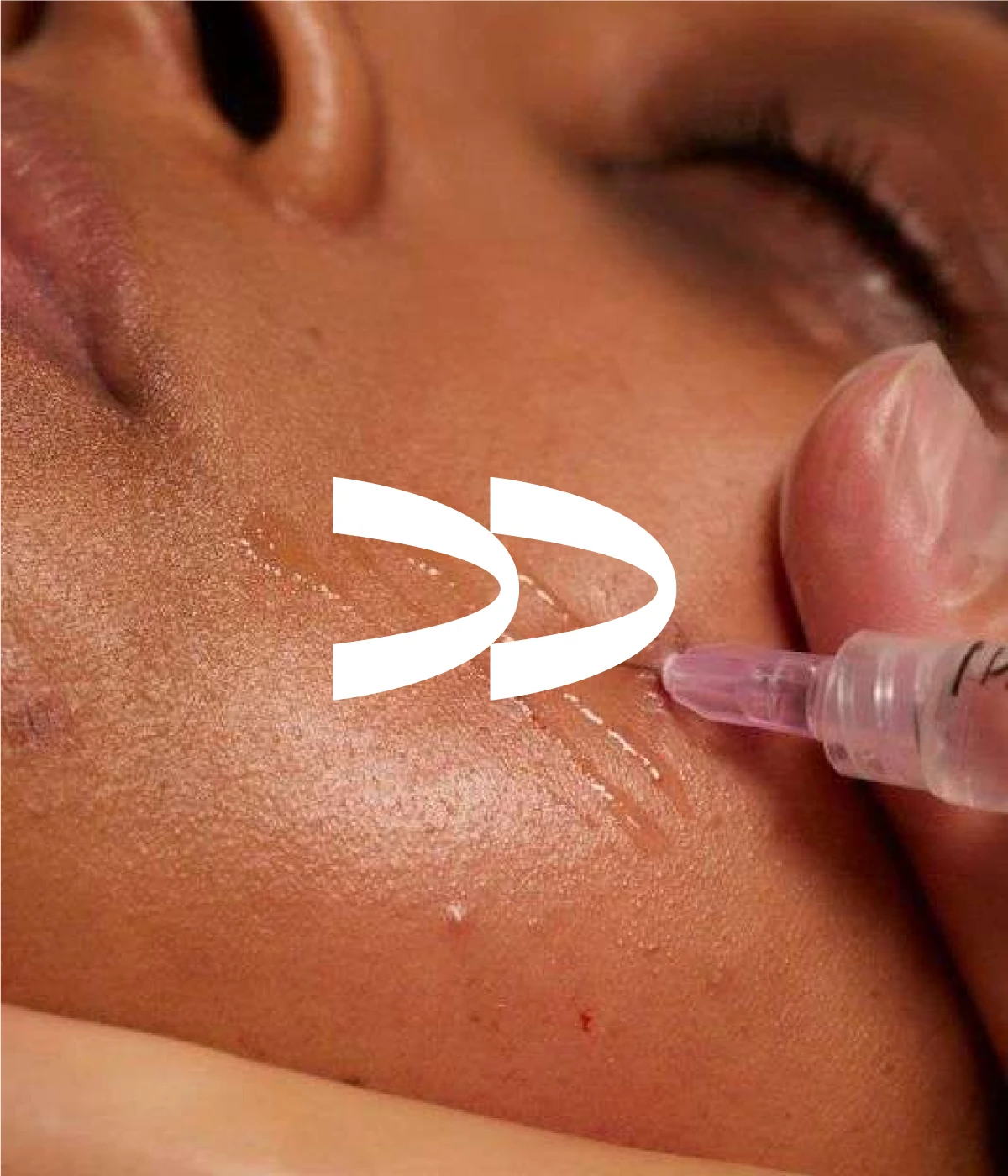 IV THERAPY